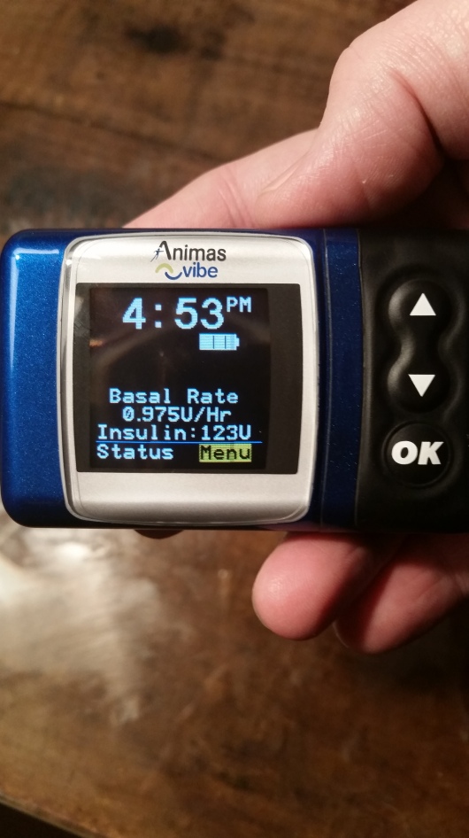 2016 was the year I finally settled on a new insulin pump: the Animas Vibe.